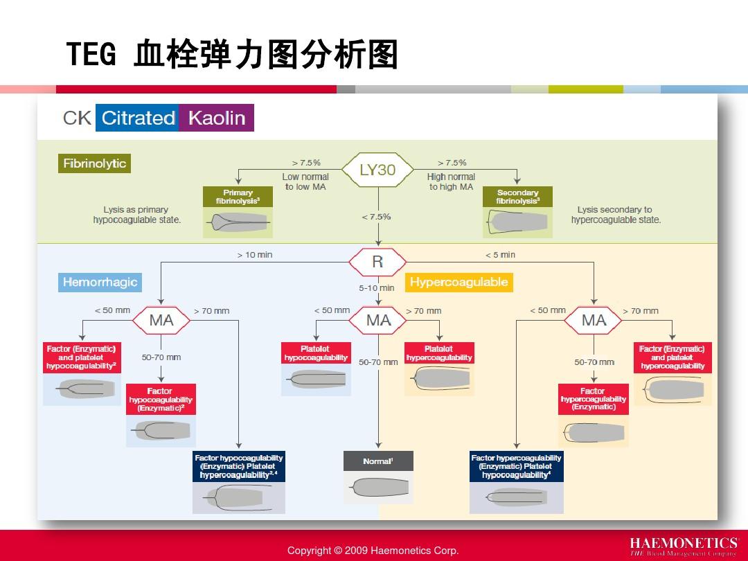 高腰弹力紧身裤裁剪图_血栓弹力图是查什么的_痔疮血栓是怎么引起的
