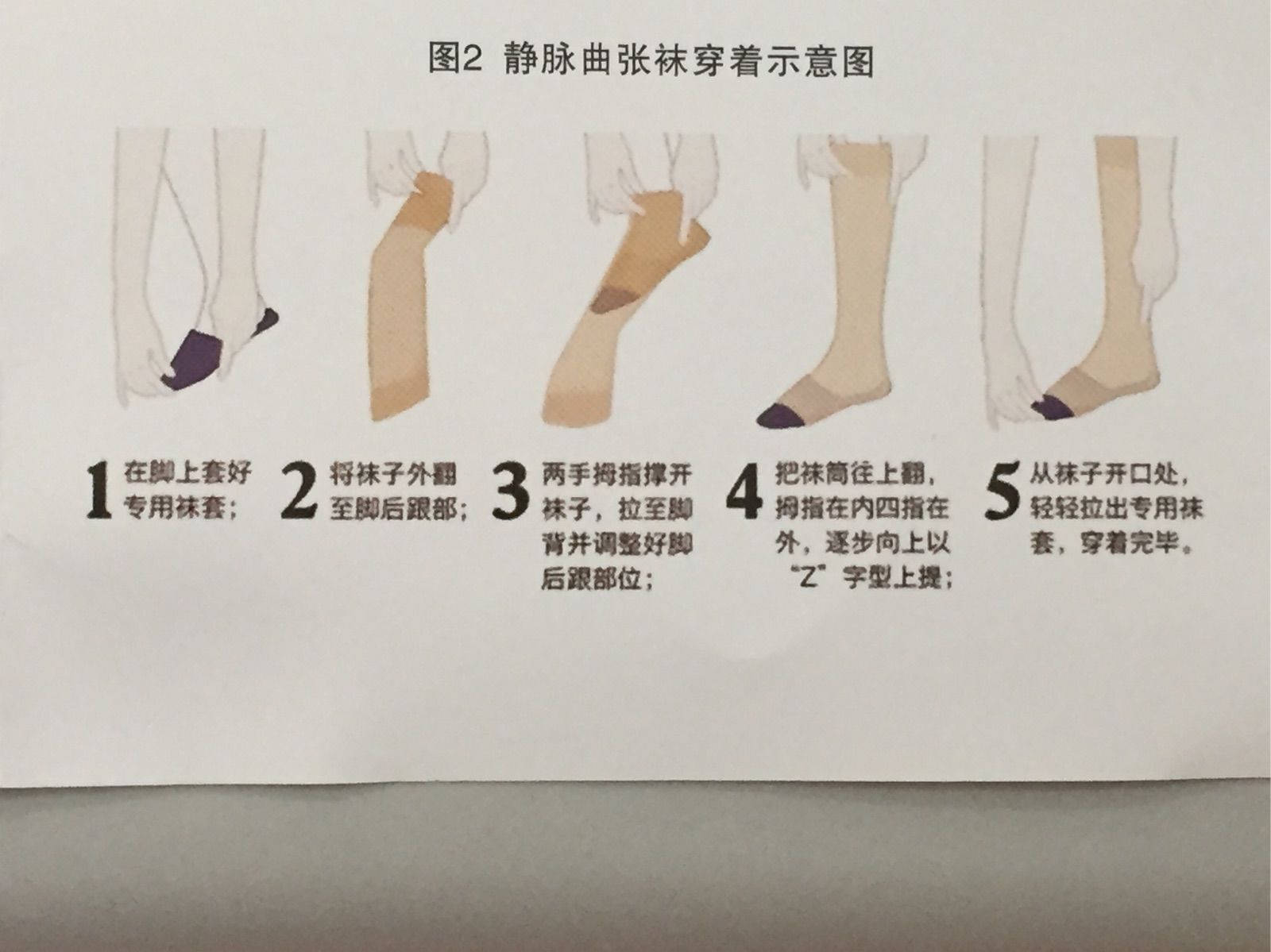 静脉平可以治精索曲张_穿弹力袜能治好静脉曲张吗_双侧静脉精索曲张图片