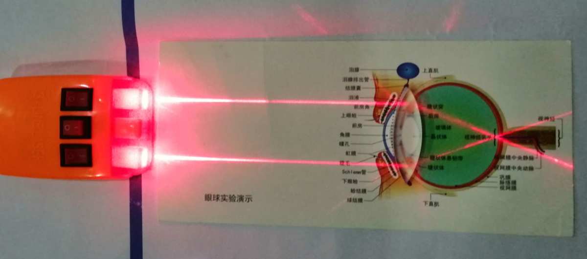 眼球凸透镜成像原理_凸透镜模拟眼球成像原理_眼睛凸透镜成像原理