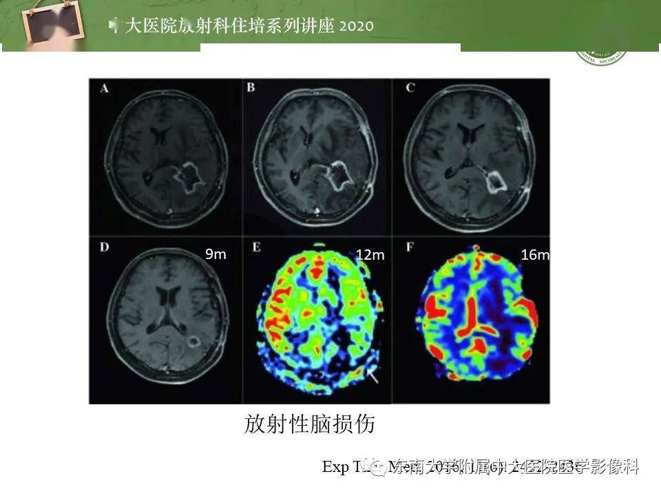 细胞膜受损的症状_细胞膜受损会怎么样_细胞膜损伤