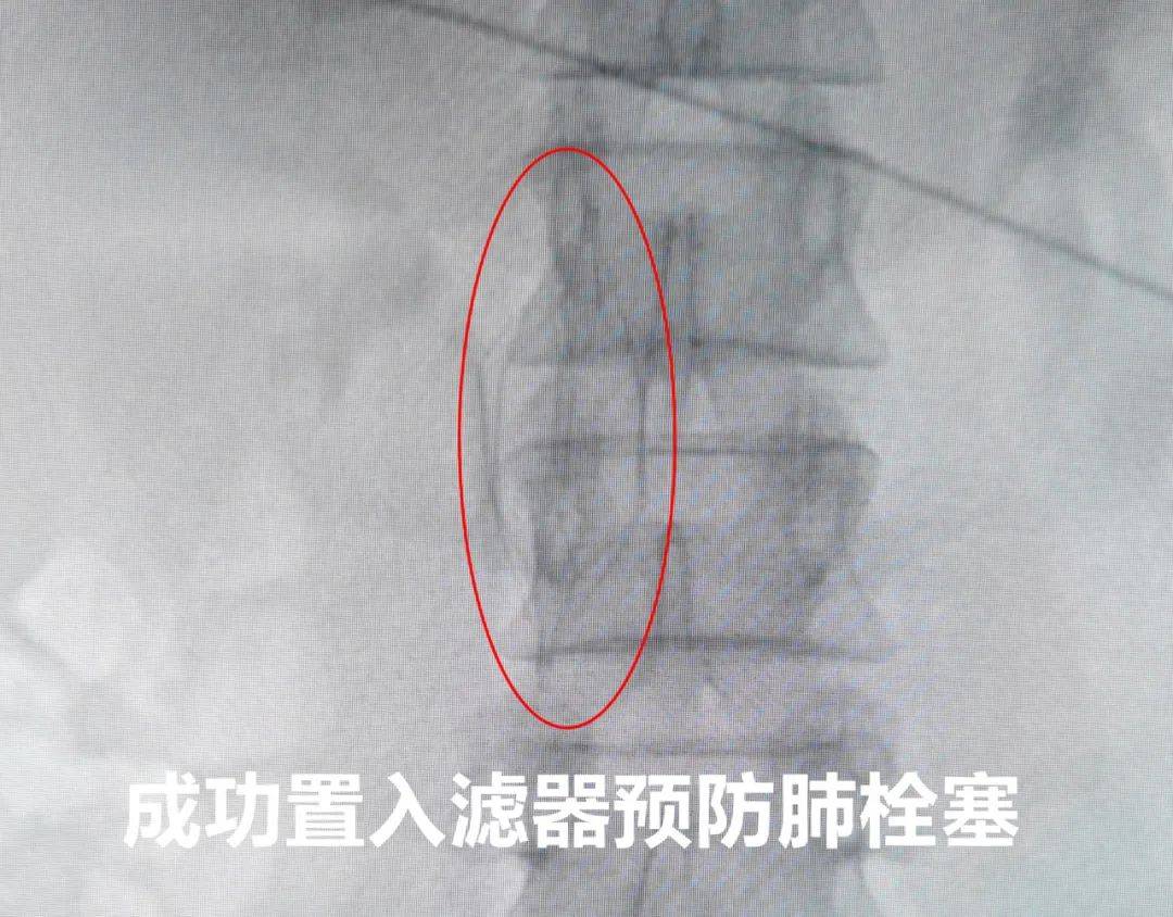 弹力绷带可以重复使用吗_弹力绷带康复用的_弹力重复绷带使用可以长期用吗