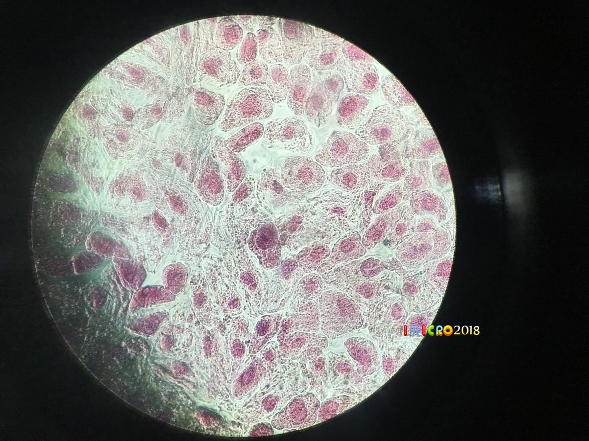 洋葱表皮实验操作步骤_洋葱表皮实验视频_洋葱表皮实验过程绘图