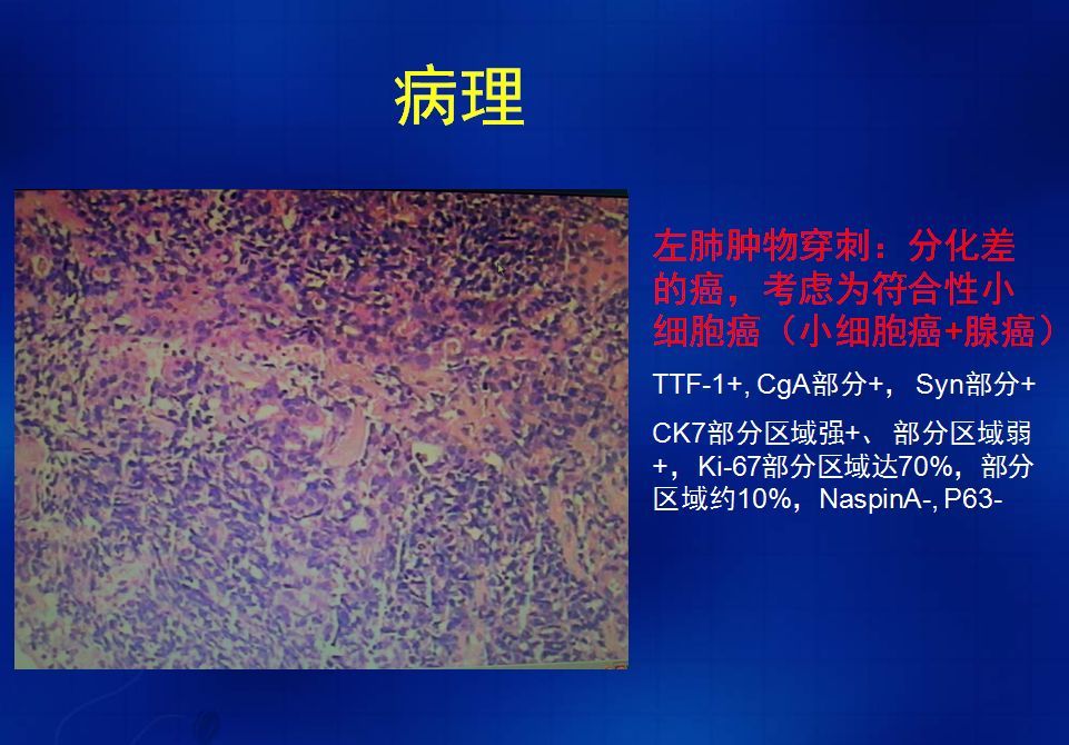细胞膜抗原功能_细胞膜抗原_膜抗原是什么